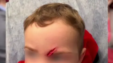 Foto ni&ntilde;o de Matar&oacute; con problemas asistenciales